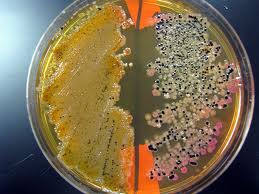Microbiology bacteria dish